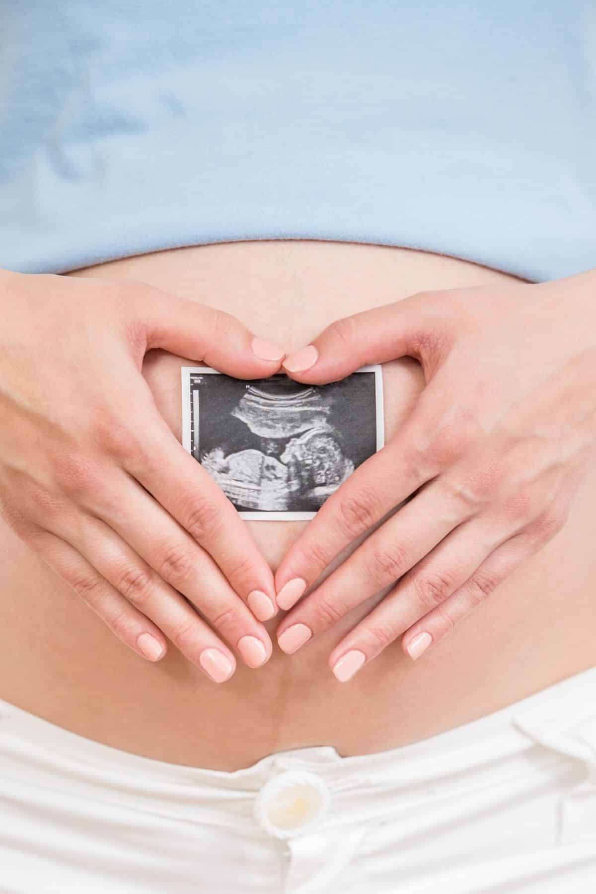 pregnant woman holding ultrasound picture.