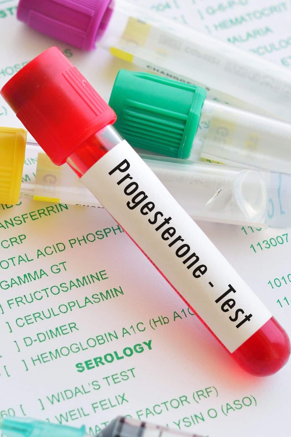 a test tube labeled "progesterone test".