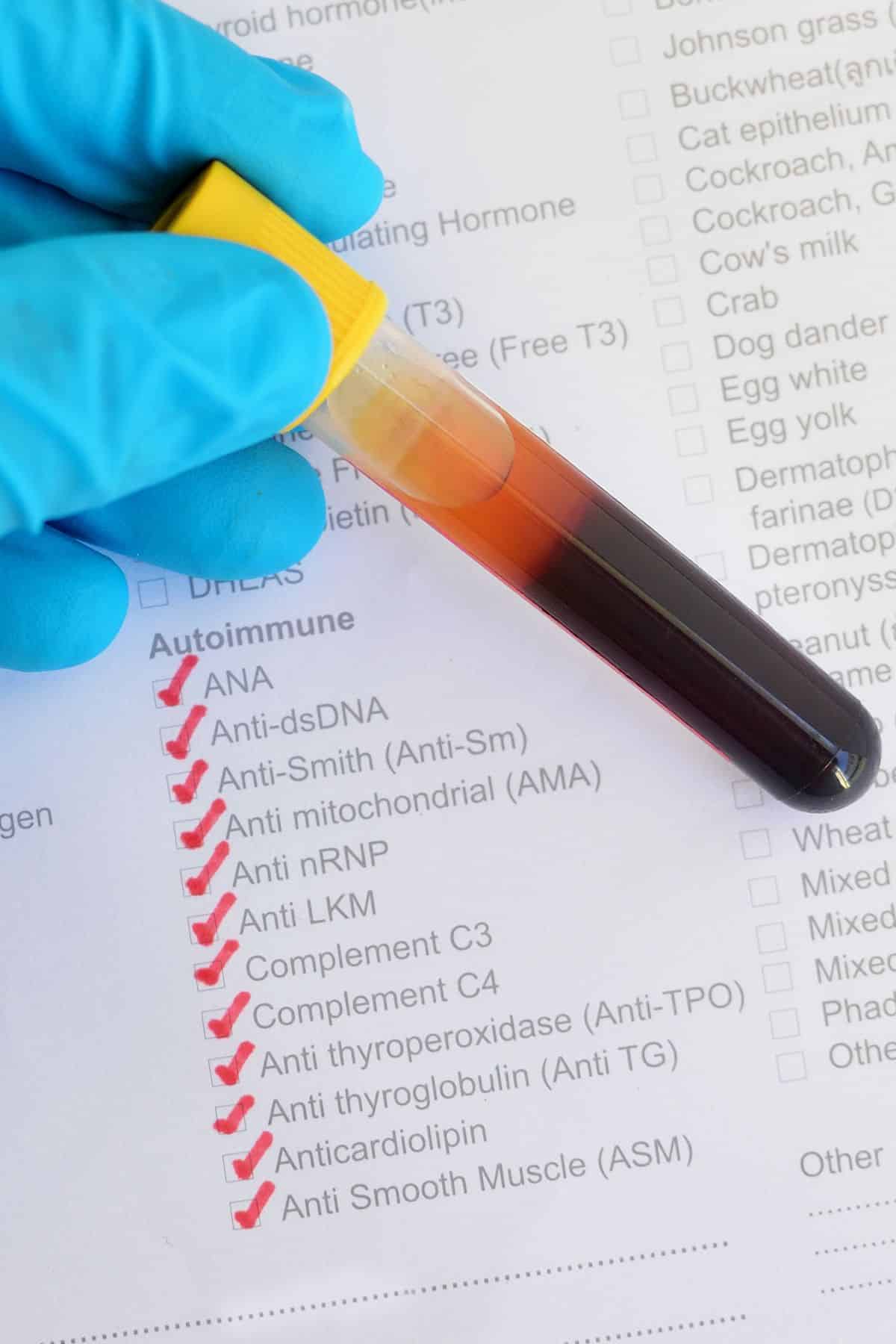 a person holding a vial over an autoimmune checklist.