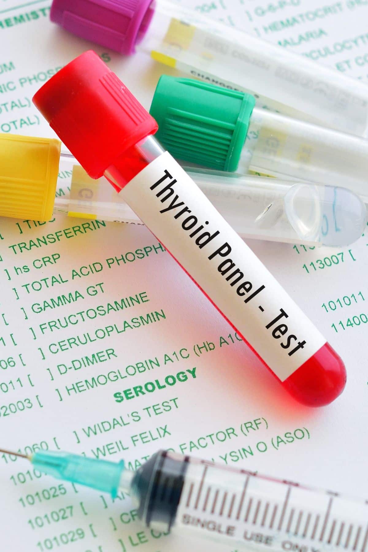 a test tube labeled "thyroid panel".