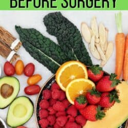 healthy foods to eat before surgery pin.