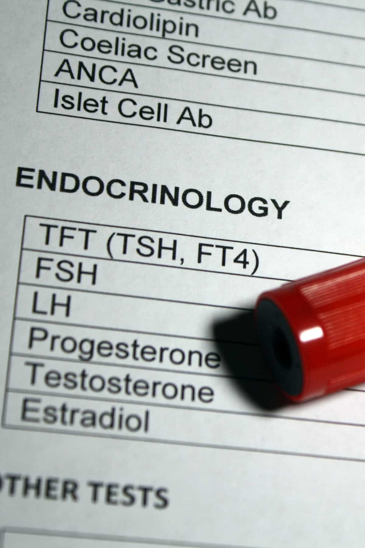 a list of hormones that are tested by an endocrinologist. 